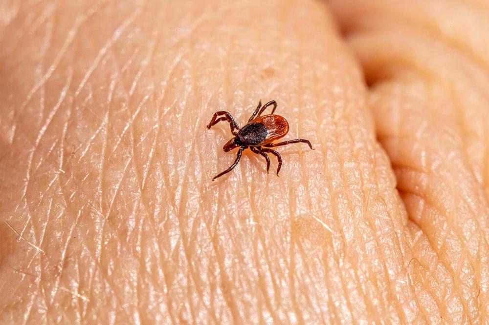 tick check